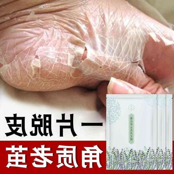 

dead xuanqingmei peeling removing skin and calluses foot film cutin desalination tender heel dryness 40ml