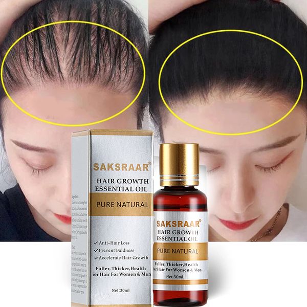 

hair care hair growth essential oils essence original authentic 100% hair loss liquid health care beauty dense growth serum