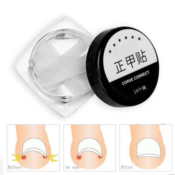 

nail art kits foot care treatment straightening tape pedicure toenail correction patch sticker tool ingrown recover band thin