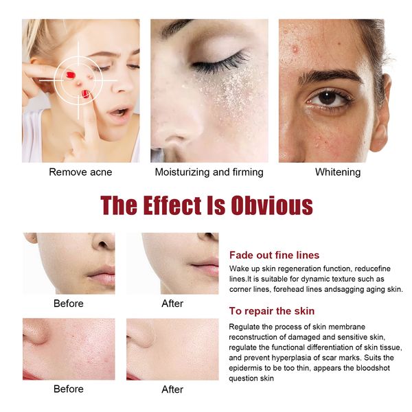 

dr pen n2 professional wireless dermapen machine bb glow mts microneedeling pen mesotherapy apparatus with 12pcs nano cartridges