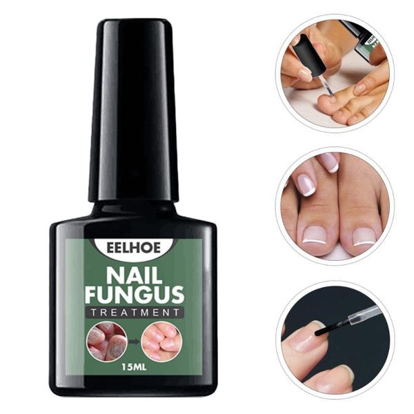 

2pcs oil natura essence liquid anti foot caring solutions nail gel, Red;pink