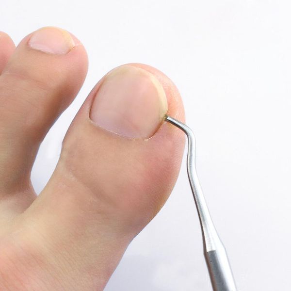 

nail art kits ingrown toe correction lifter file clean installation tool pedicure foot care hook cleaner double sided