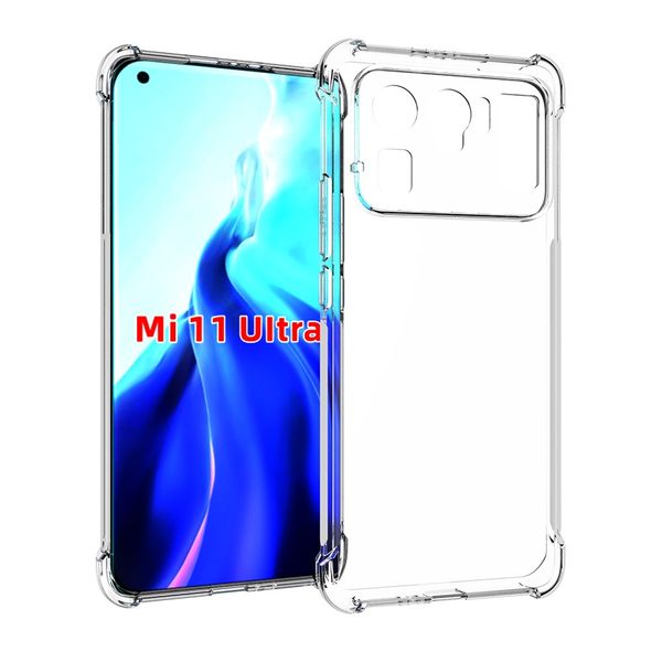 Прозрачный для Xiaomi 11 Ultra Case Soft Gel Skin Clean Clear Clife Mi 11 Lite Pro Cover