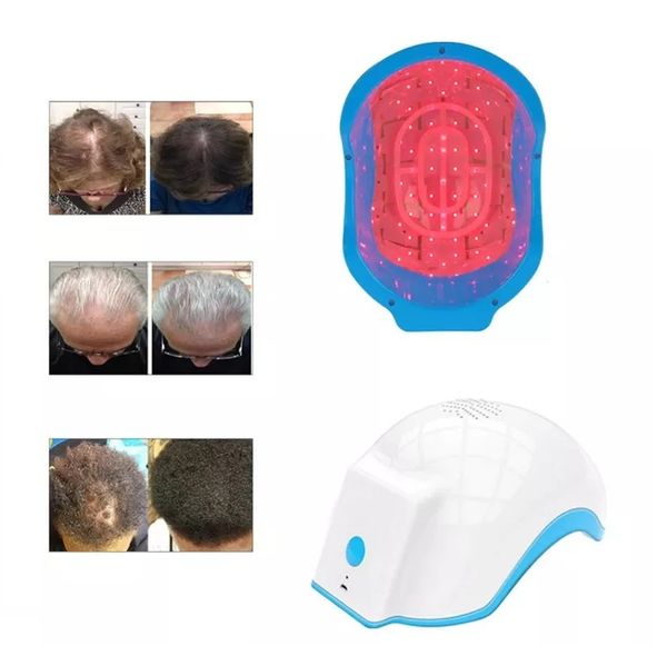 

rechargeable laser hair regrowth helmet 678nm hair low light extension laser cap treating hair loss, Black