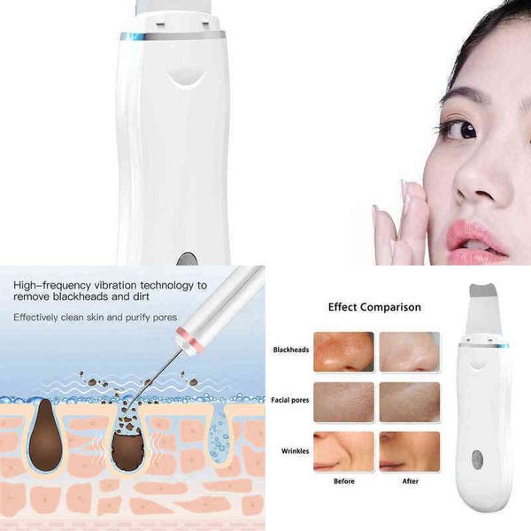 

nxy face care devices face care devices steamerultrasonic skin scrubber facial cleaner ion acne blackhead remover peeling shovel massager li