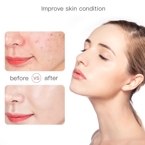 

wireless microneedling pen dr pen electric skin care tools professional derma tattoo gun dr pen mesotherapy acne scar removal perfections