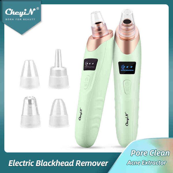 Dispositivos de cuidados de rosto CKEYIN REMOVER BLATHELHED GREEN CLETHEND PORE ACTOR COR ACNE PIMPLE Microdermoabrasão Black Head Chead Beauty Skin 0727