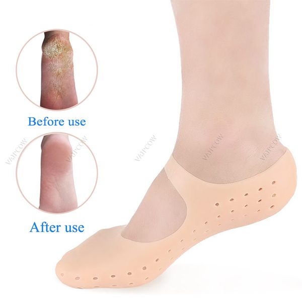 2pcs = 1Pair silicone palmilha hidratante peock saltos protetor anti rachadura pés spa meias sapatos de gel sapatos palmilhas pés cuidados pedicure meia