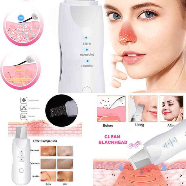 

nxy face care devices electric skin scrubber vibration face spatula blackhead remover clean peeling rf led pn radio mesotherapy facial lifti
