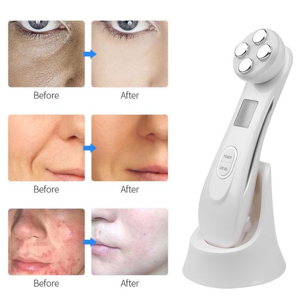 

5 in1 rf ems electroporation led p on light therapy beauty device anti aging face lifting tightening eye care massager 220620