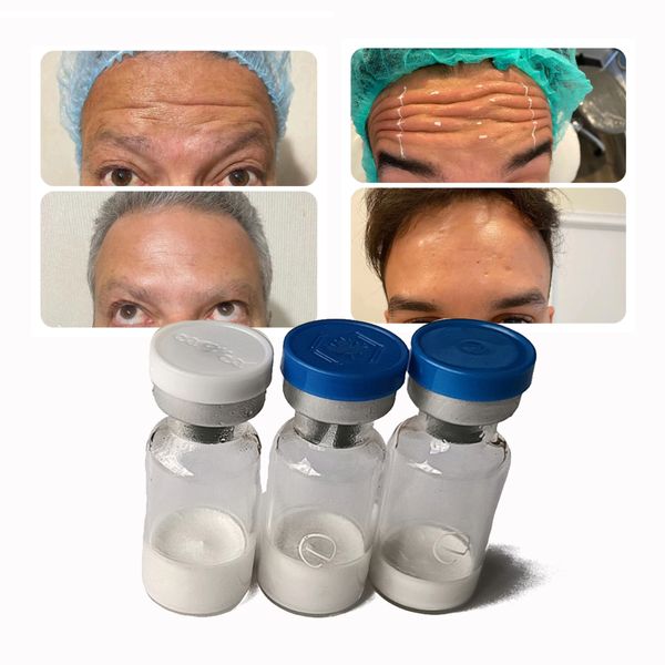 

anti wrinkle israderm botax injection 100 u inject facial private label near me