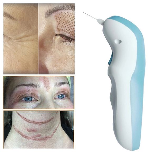 Maglev Laser Plasma Pen Tattoo Mole Dark Spot Skin Tag Remover Device Augenlid Lifting Wart Mole Removal Pen Beauty Care Machine