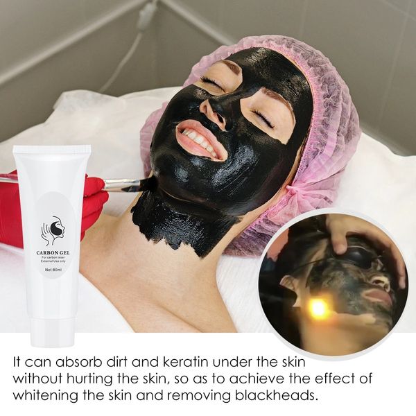 Neuankömmling Zubehör Teile Soft Carbon Peeling Creme Gel für ND Yag Laser Laser Hautverjüngung Behandlung Aktivkohle Creme