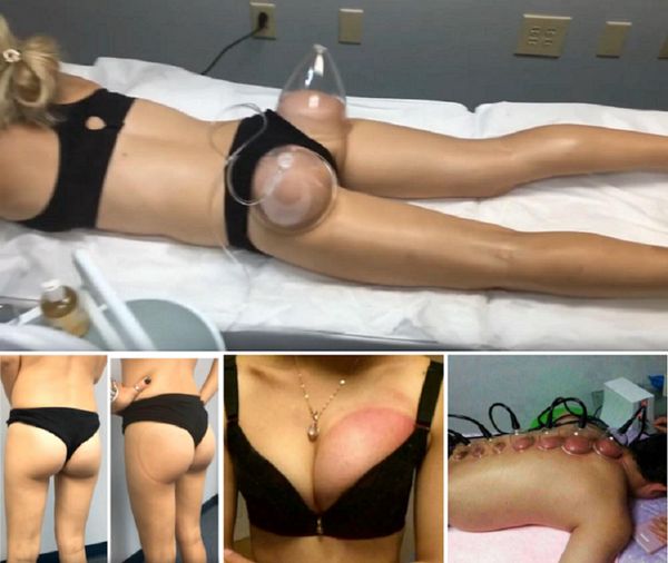 Nátrio de vácuo Aprimoramento de peito S-Forma de Série Sistema de Cavitação Sistema de Levantamento de Vácuo Cupping Therapy Máquina