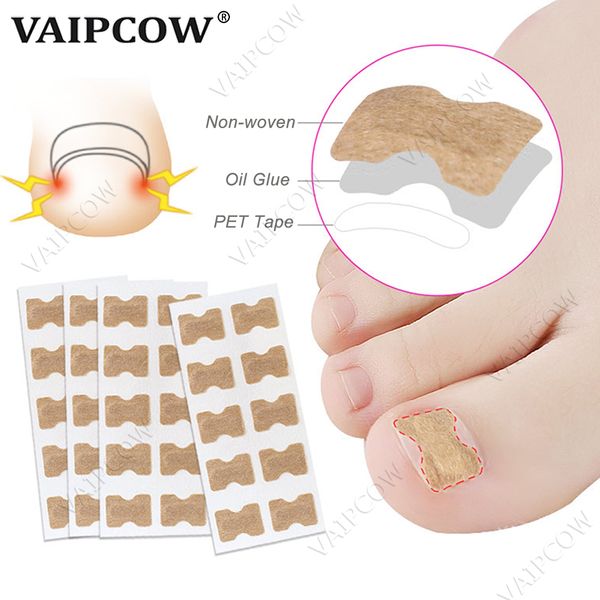 10 pcs ingrown toenail Corrector adesivos Paronhachy Tratamento Recuperar Corretor Pedicure Tool unha de toe unha cuidado