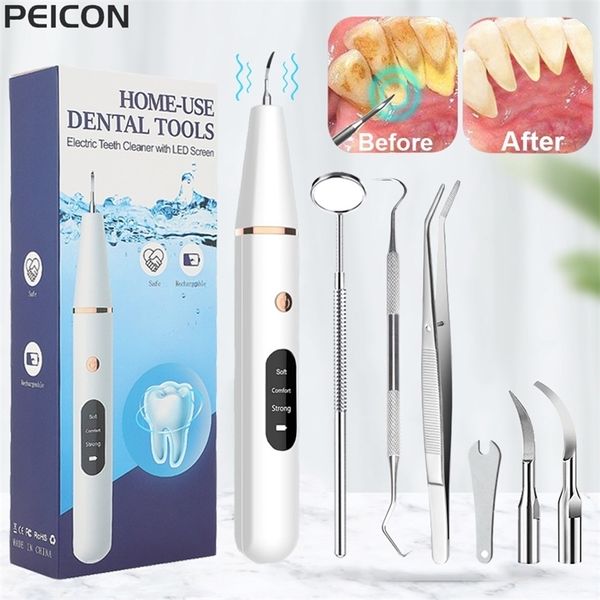 Ultra Scaler para Remoção de Pedra Tartar de Cálculo de Planos de Tartar dentes Remoção de Pedra Dental 220623