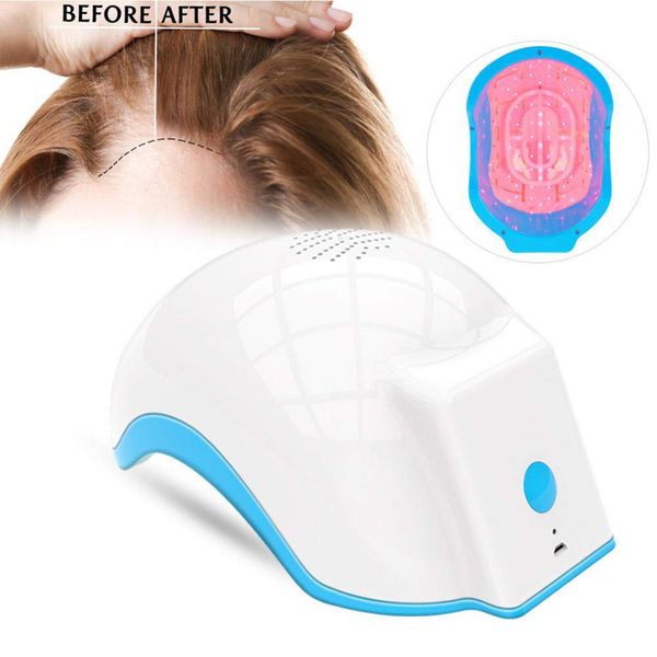 

bio diode laser light 650nm lllt home use for hair growth transplant anti-hair removal helmet haircare cap, Black