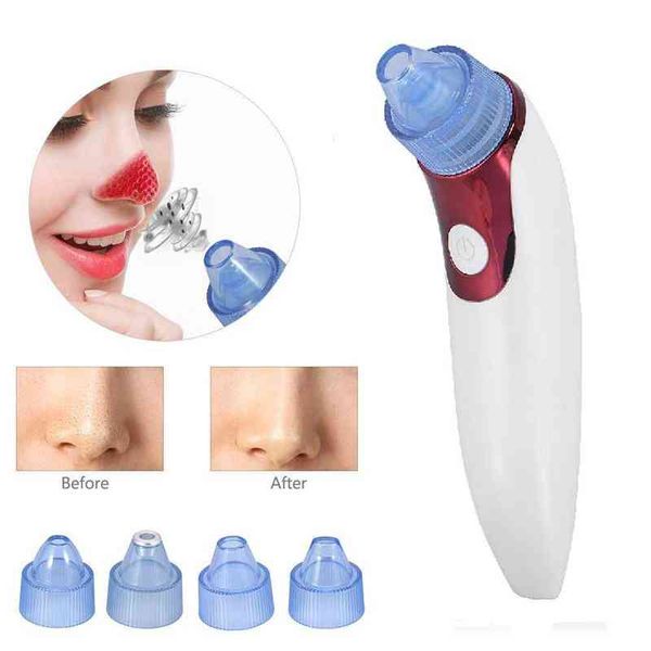 

black head vacuum suction remover electric facial pore cleanser acne pimple blackhead extractor rechargeable skin care tools 220520