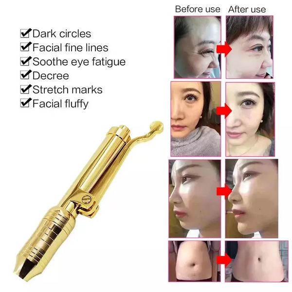 

0.3 hyaluron pen with 0.3ml ampoule nozzle meso gun lip lifting anti wrinkle loss weight lip no liquid, Black;white