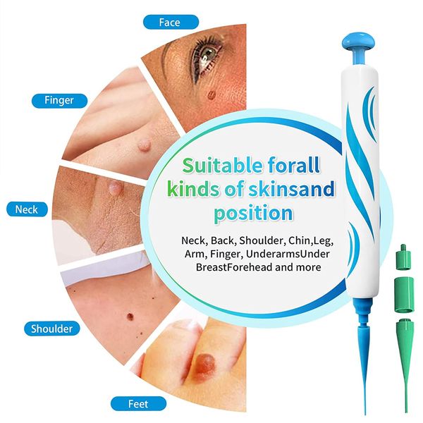 

2 in 1 auto micro skin tag remover device standard and micro skin tag removal kit mole wart remover face care beauty