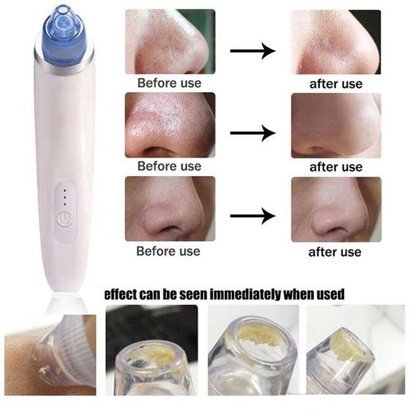 Aspirador portátil Cleaner Blackhead Cleaning Acne Mucus Sputum USB Carregamento Dérmico Facial Hidratante Ferramentas Black Máscara