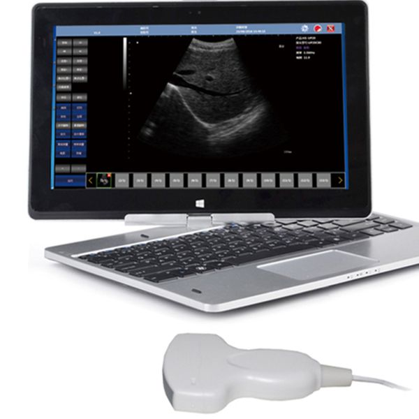 

Free Ship Advanced USB convex probe with ultrasound scanner software and advanced quality / Эхо-машина / малый ультразвуков