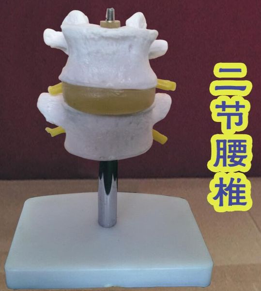 

wholesale new human skeleton model lumbar disc disease model spine model lumbar bone lesionsl medical science teaching mannequins 1pc c009, Black