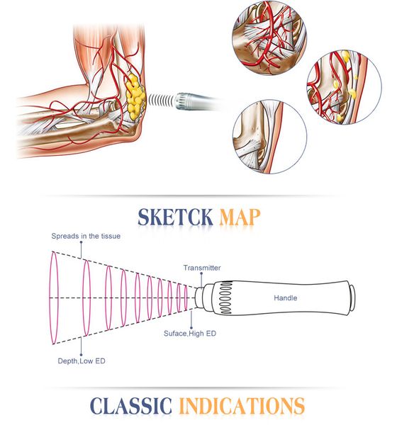 Alívio da dor muscular Radial Shockwave Therapy Dispositivo de choque onda acústica terapia de onda de choque onda máquina de fisioterapia para lesão esportiva