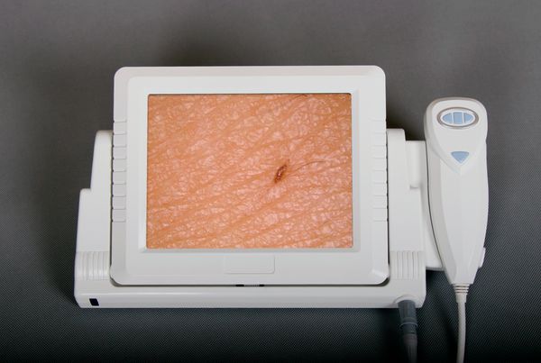 

2020 new all in one 2.0 mp high resolution ccd skin analysis camera with 8 inch lcd monitor and 4 compare images dhl ship