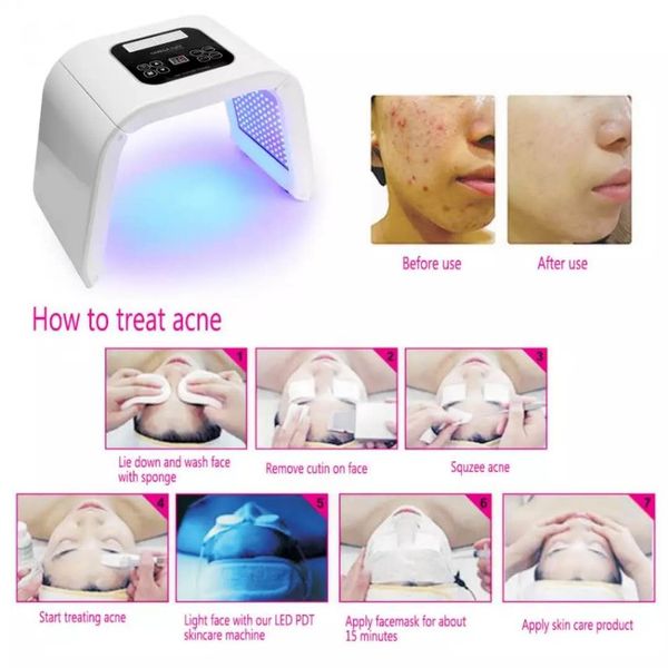 

light pdt led therapy acne freckle removal whitening pn beauty machine for home beauty salon family use