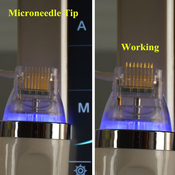 

microneedling советы по омоложению кожи Уход за кожей Microneedle частичный rf microneedle машина удаление растяжек бесплатная доставка