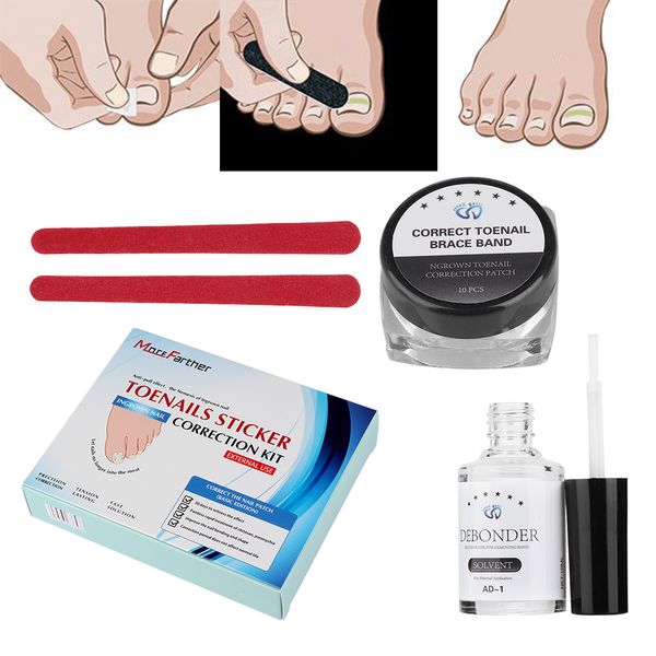 1set 10 pcs elastic ingrown toe unha pedicure patch straighting clipe cinta com cola pedicure ferramentas toenail conjunto de ferramentas de correção