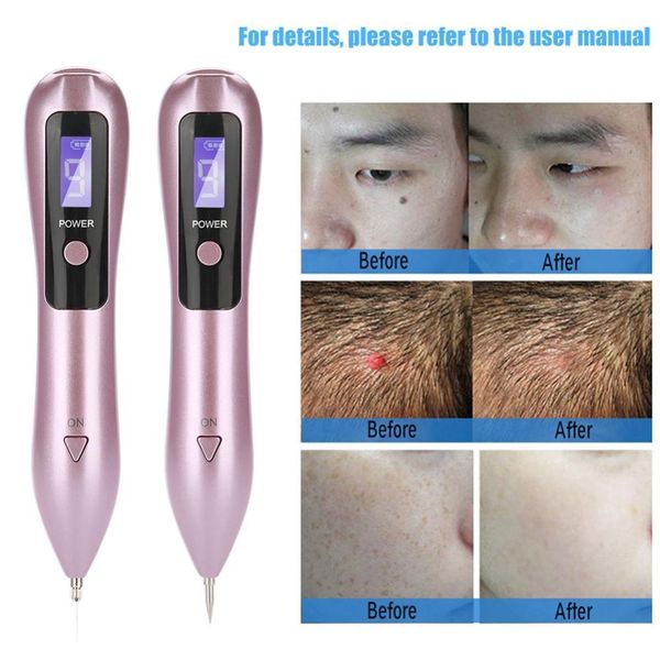 

9 level lcd laser plasma pen face skin dark spot remover mole tattoo removal machine salon home facial freckle wart eraser pen