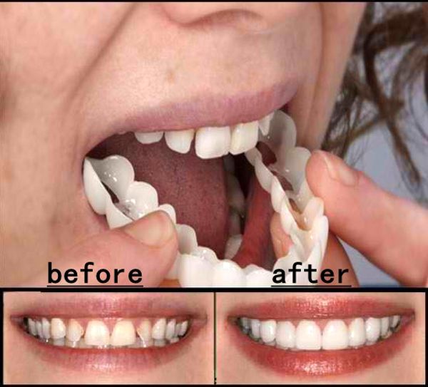 

Cosmetic Dentistry Snap On Smile Instant Smile Comfort Fit Flex Cosmetic Teeth One Size Fits Most Comfortable Denture Care