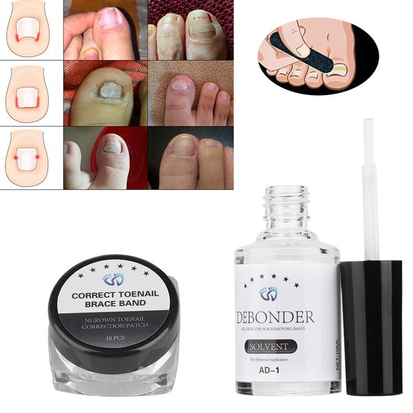 

10pcs /set toenail correction tool set ingrown toe nail pedicure elastic patch straightening clip brace with glue pedicure tools