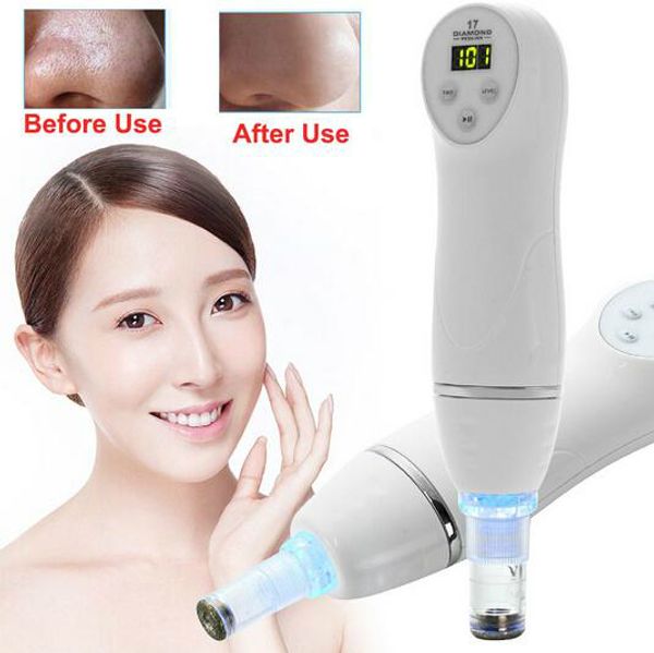 

new mode microdermabrasion diamond peeling beauty machine blackhead removal skin peel diamond dermabrasion pore cleansing for home use