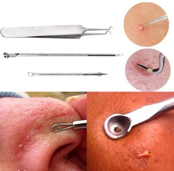 

new arrival 3pcs stainless steel silver blackhead facial acne spot pimple remover extractor tool comedone oc12