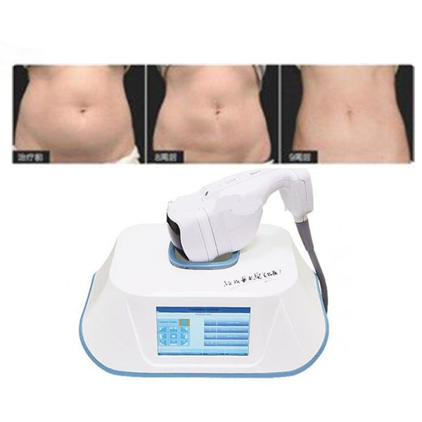 

hifu ultrashape liposonix portable slimming weight loss machine/liposonix hifu/hifu ultrashape