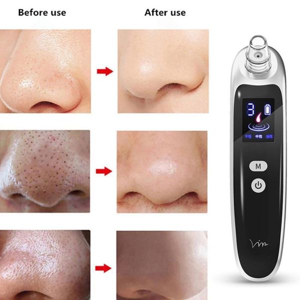 

electric acne blackhead vacuum cleaner pore skin care tools nose face deep cleansing suction machine with 6 head birthday gift