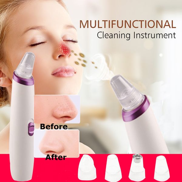 

blackhead remover face deep cleaner pore acne pimple removal vacuum suction facial diamond beauty clean skin care spa tool