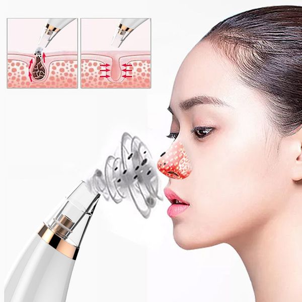 

electric blackhead instrument cleansing pores clean to acne to blackhead instrument artifact blackhead remover toolsu174