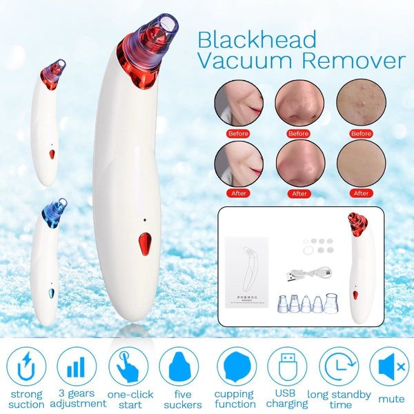 

vacuum pore cleaner blackheads electric acne clean exfoliating cleansing facial instrument comedones remover face skin car