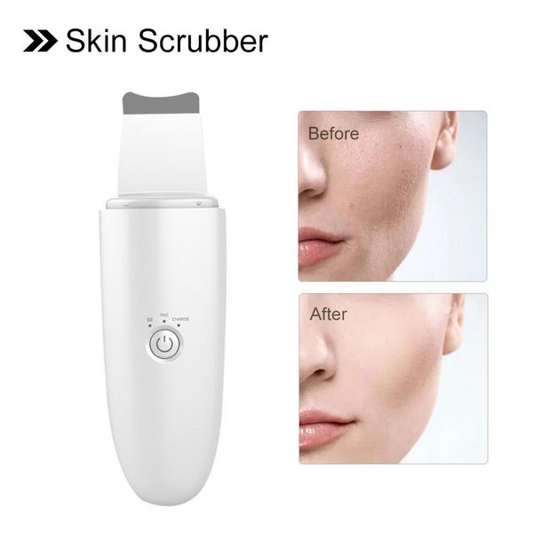 

skin scrubber blackhead removal machine usb rechargeable acne pores cleanser exfoliator for facial deep cleansing face care