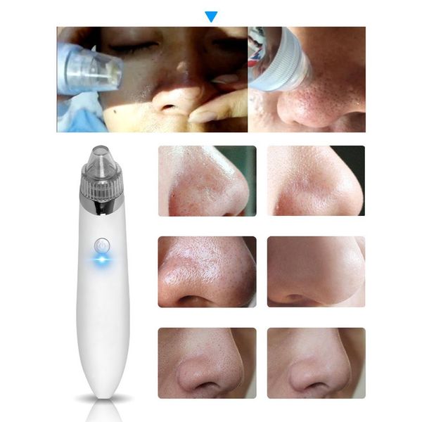 

electric blackhead instrument household beauty facial pore cleaner cleansing instrument no battery english