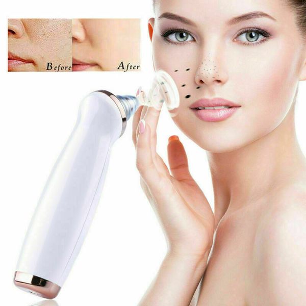 

miqmi skin vacuum blackhead remover suction face pore vacuum cleaner anti acne pimple remover tool diamond peeling pore clean
