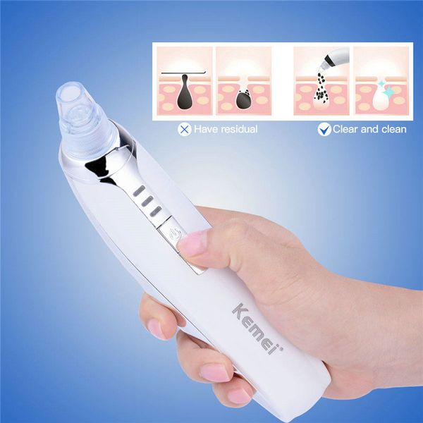 

kemei electric portable removal blackhead km-1868 suction facial pore cleaner acne remover migliore depilazione nasale rlagp