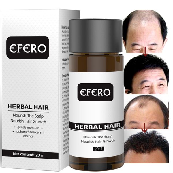 

1pc 20ml hair loss serum essential oil liquid dense hair fast growth serum hair care prevent baldness anti-hair loss serum tslm1