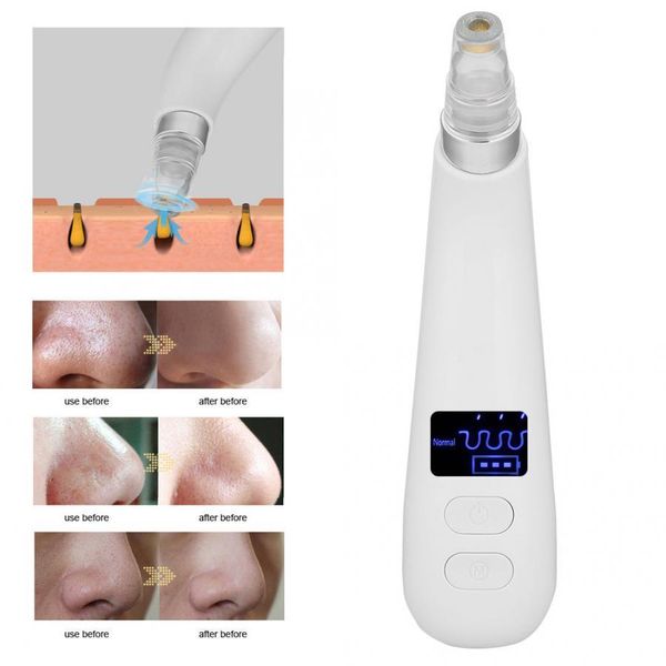 

electric blackhead acne suction removal usb pore cleaner facial skin cleansing face massager pore vacuum cleaner