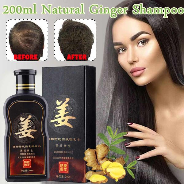 

hair growth products ginger oil hair growth faster grow hair ginger shampoo sloss treatment grow thick growth