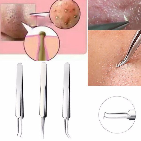 

1pcs acne tweezer comedo removal pimple needle black head extractor skin care tools